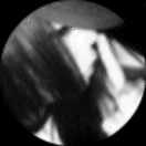 小星